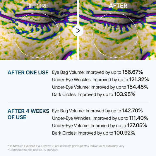 Eyephalt Miracle Repair Cream – Egf-Infused under Eye Savior (0.33 Fl.Oz)