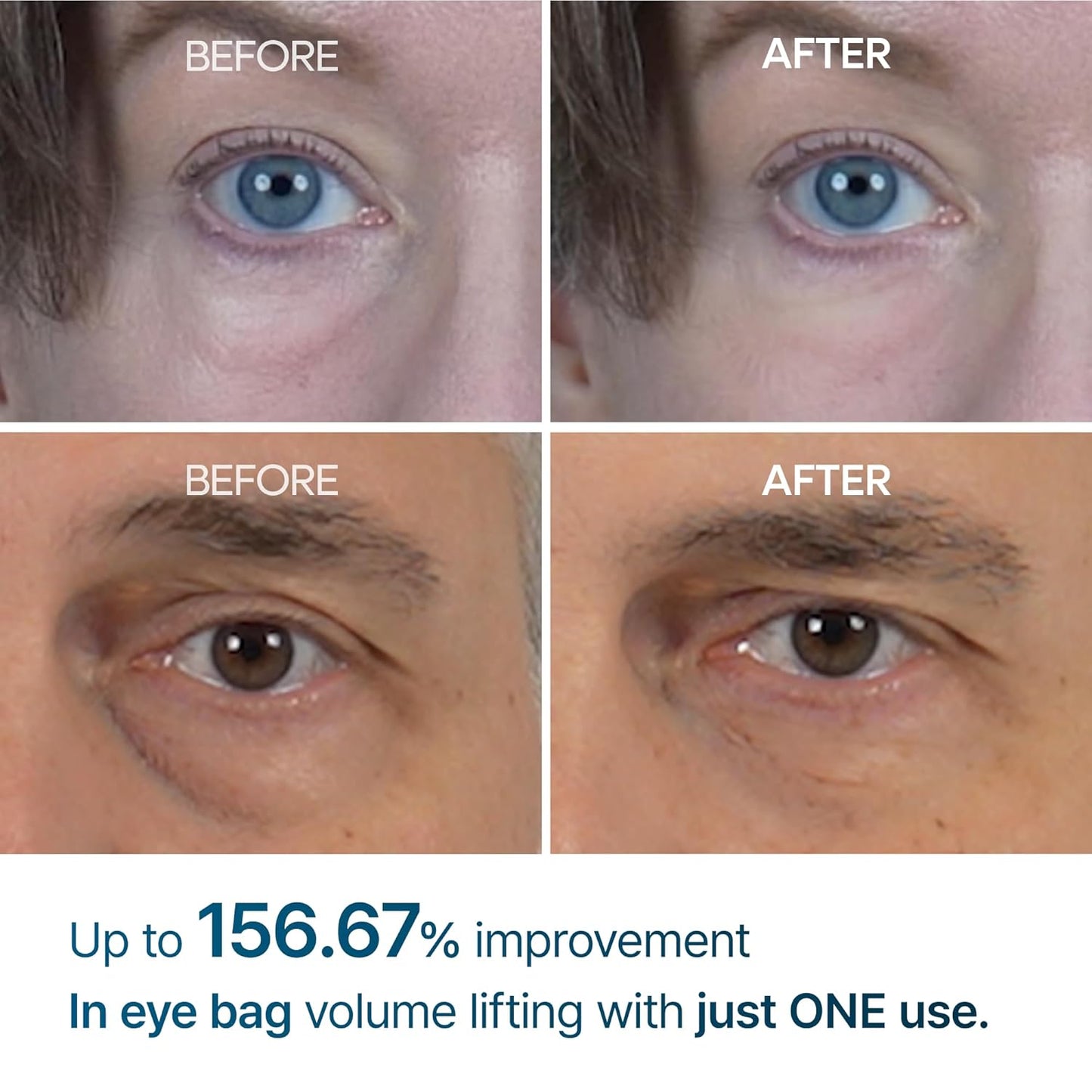 Eyephalt Miracle Repair Cream – Egf-Infused under Eye Savior (0.33 Fl.Oz)